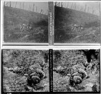 Soldat intoxiqué Verdun 1917 (vue 1). Bataille de Champagne 1915 (vue 2)
