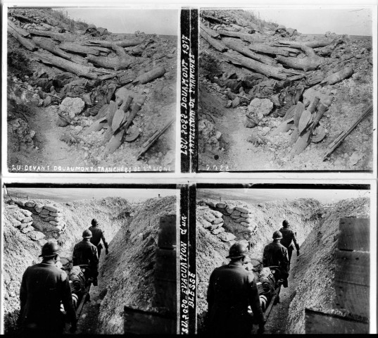 Douaumont 1917. Artilleurs de tranchée. Devant Douaumont tranchée de 1ère ligne (vue 1). Evacuation d'un blessé par un boyau en Champagne (vue 2)
